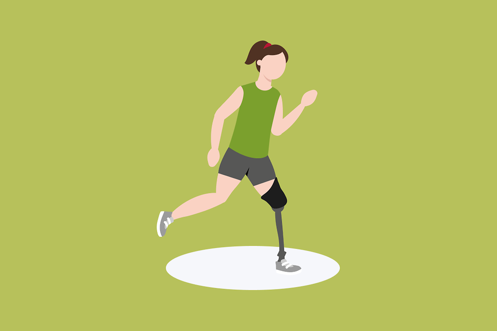 Eine Frau mit einer Beinprothese 